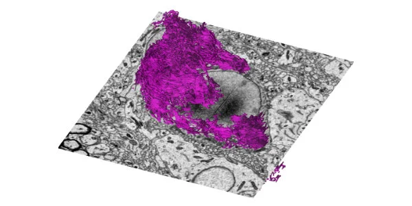 3dEMtrace sample reconstruction